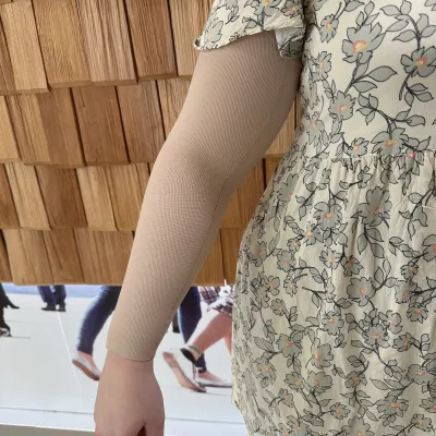 Kompressionsärmel in Hautfarbe am Arm zur Behandlung eines Lymphödems