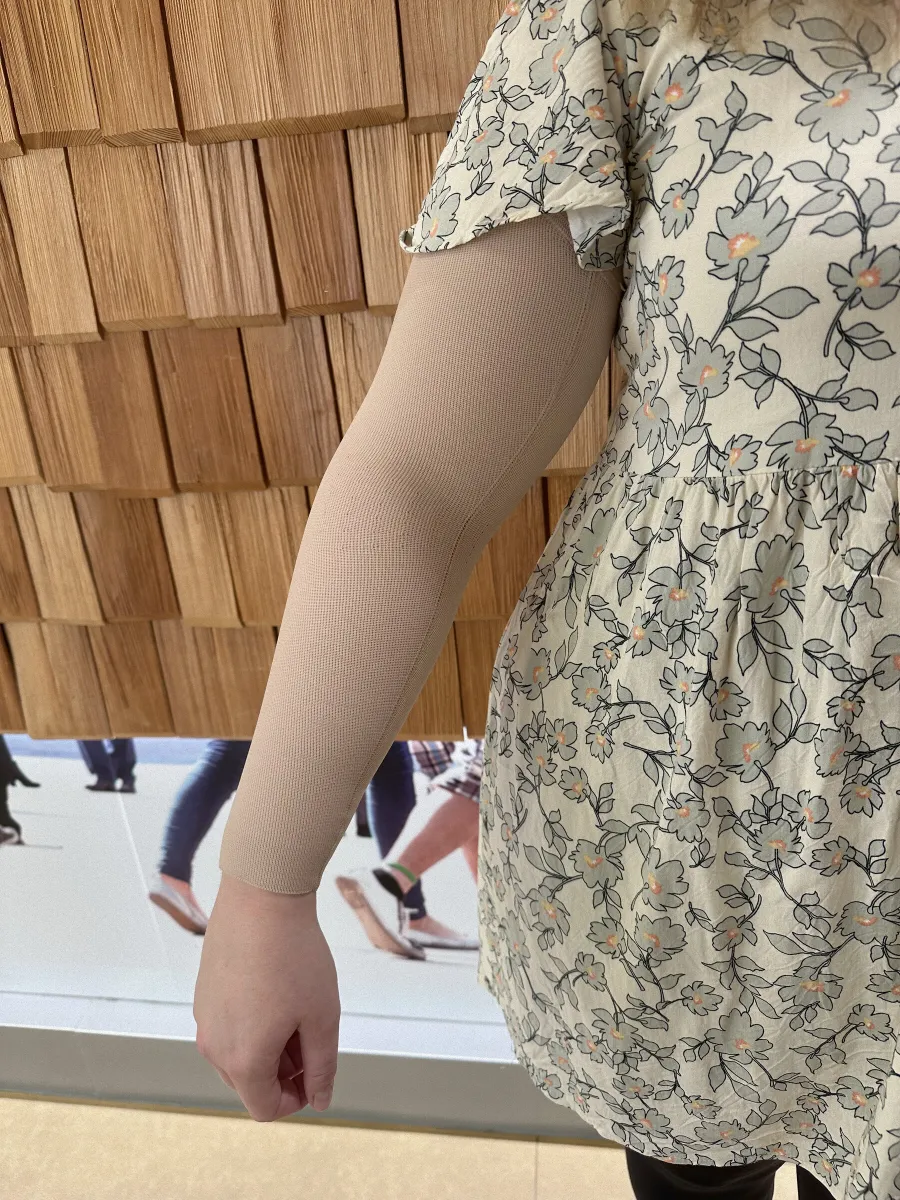 Kompressionsärmel in Hautfarbe am Arm zur Behandlung eines Lymphödems